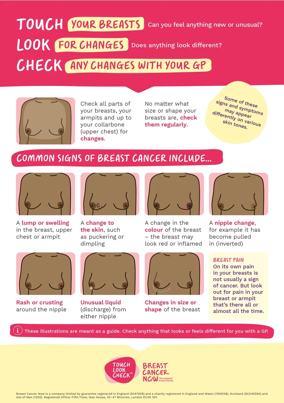 common signs of breast cancer